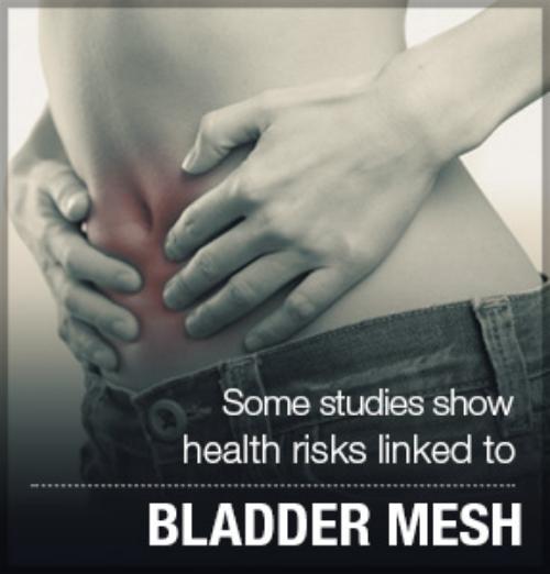 bladder mesh lawsuit